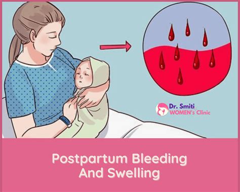 Postpartum bleeding and swelling. What's normal? - drsmitiwomensclinic.in