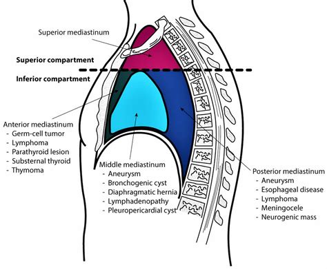 Mediastinum anatomy, location, cavity, organs, function & tumors