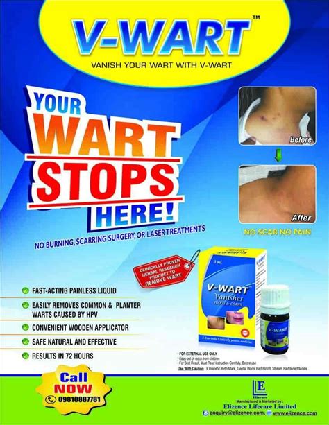 Buy V-Wart Remover Liquid Rapidly Eliminates Both ar and Common Warts ...