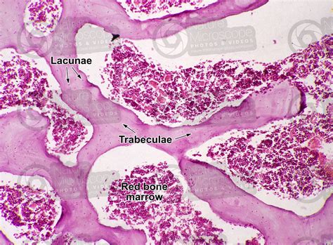 Spongy Bone Under Microscope