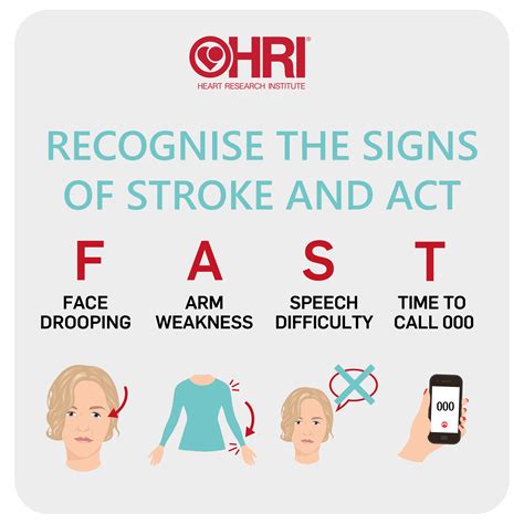 A paramedic’s perspective on stroke • Heart Research Institute