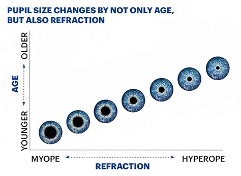 Pupil Size Chart Normal