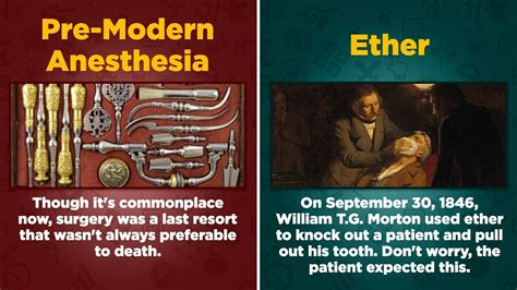 The Terrifying History of Anesthesia | Cracked.com