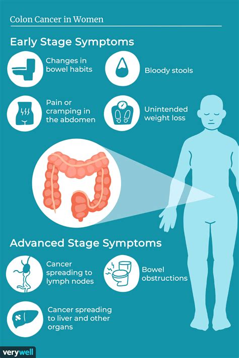 Symptoms of Colon Cancer in Women