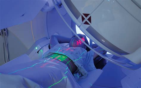 Stereotactic Body Radiation Therapy: A New Paradigm for Radiation ...