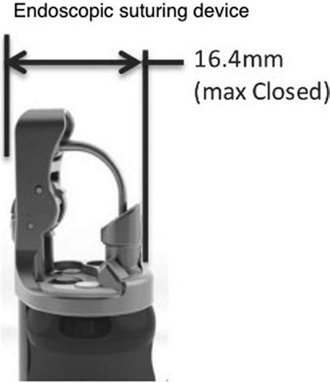 Diameter of endoscopic suturing device. | Download Scientific Diagram
