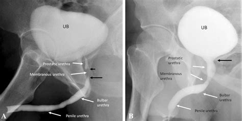 Urethrogram Anatomy