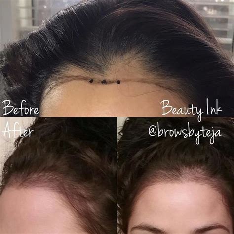 Got A Receding Hairline? These Tattoos Are Giving Women Their Groove ...