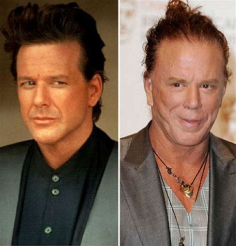 Celebs Who Aged Terribly - Stuff-Articles | Plastic surgery gone wrong ...