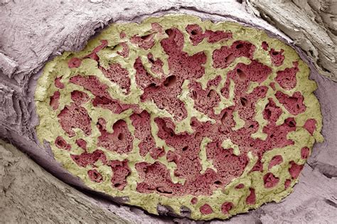 Bone Marrow: Structure, Function, Diseases and More