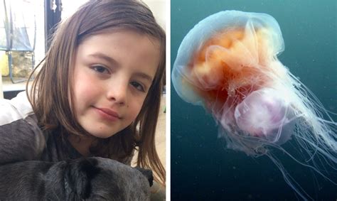 Warning after sting from 'huge' jellyfish off Fife coast leaves boy, 9 ...