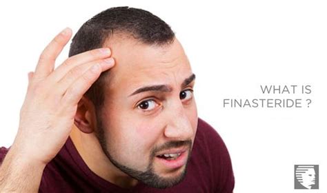 Finasteride & Minoxidil: Are You Ready To Pay For Side-Effects? - AHS India