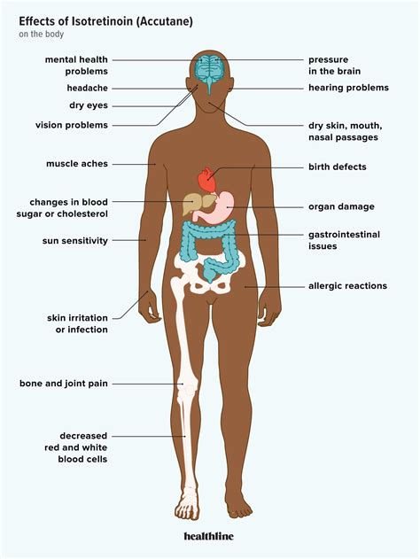 Accutane: What Are the Side Effects on the Body?