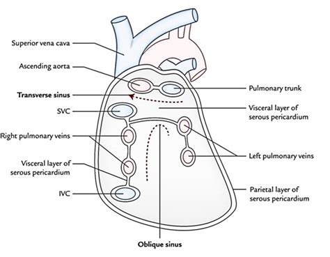 Transverse Pericardial Sinus