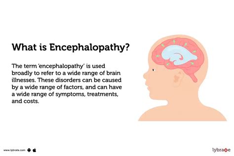 Encephalopathy: Treatment, Procedure, Cost, Recovery, Side Effects And More