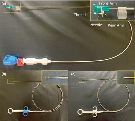 Endoscopic suturing using a new device to prevent adverse events after ...