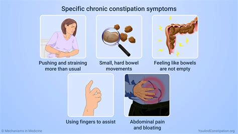 Slide Show - Diagnosing Chronic Constipation