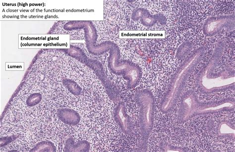 Uterus – Normal Histology – NUS Pathweb :: NUS Pathweb