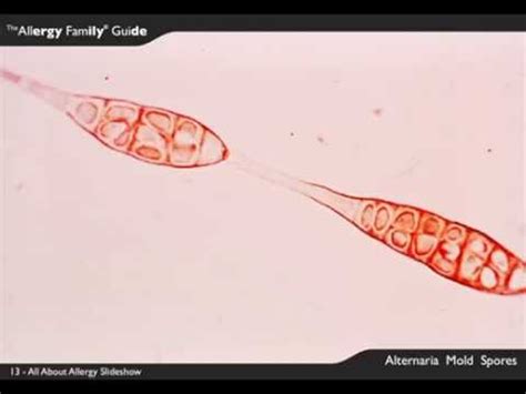 All About Allergy Slideshow - Alternaria Mold Spores, 13 of 29 - YouTube