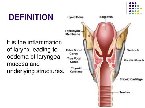 Can you permanently lose your voice from laryngitis: Laryngitis ...