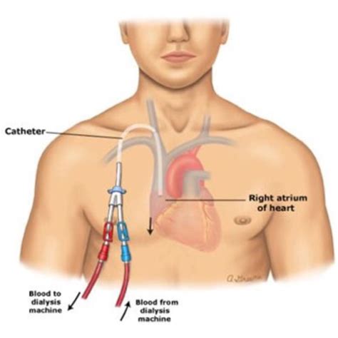 Pin on Medical: Heart & Veins