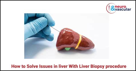 How to Solve Issues in liver With Liver Biopsy procedure