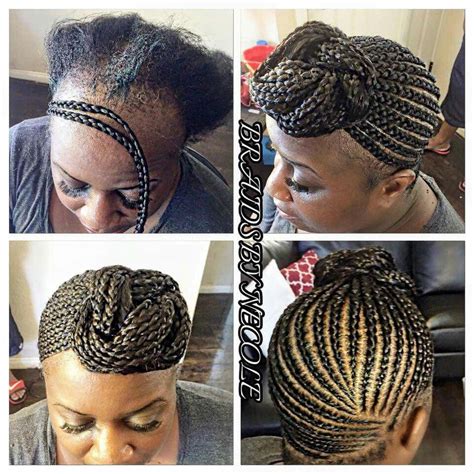 Nice #baldhead | Alopecia hairstyles, Braids for thin hair, Braided ...