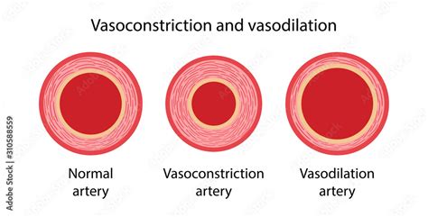 Obraz Arterial vasoconstriction and vasodilation. Comparison ...