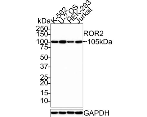 ROR2 Recombinant Rabbit Monoclonal Antibody [JE37-72] (HA721417) – HUABIO