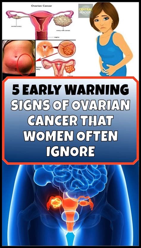 Five Early Warning Signs Of Ovarian Cancer You Should Never Ignore