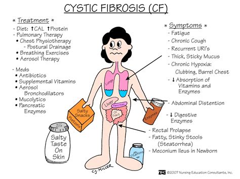 cystic fibrosis – My Wonky Life