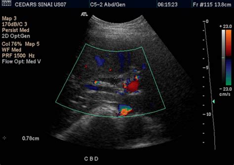 Testicular Ultrasound Preparation – Telegraph