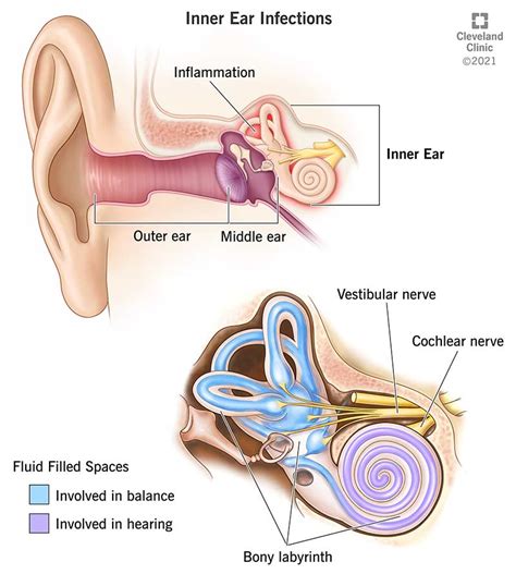 Top 18 what happens when ear infection spreads head 2022