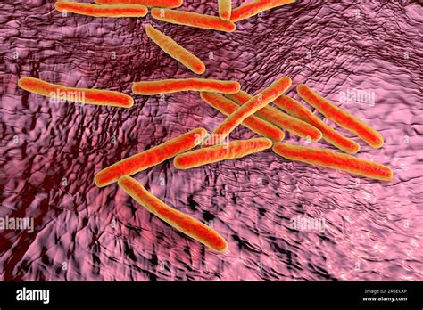 Tuberculosis bacteria. Computer artwork of Mycobacterium tuberculosis ...