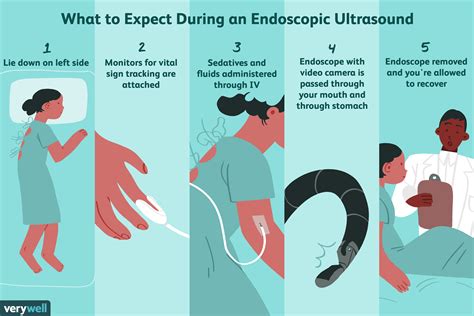 Endoscopic Ultrasound (EUS): Uses, Procedure, and Risks