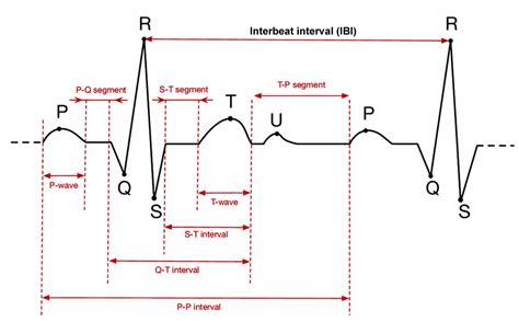 Sinus rhythm, normal sinus rhythm & sick sinus rhythm