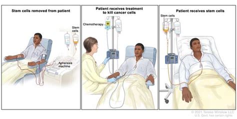 Bone Marrow Transplant Procedure