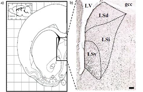 Lateral septal nucleus: a) black rectangle indicates the LSN, adapted ...