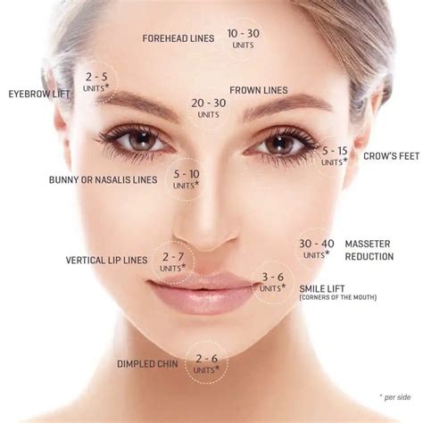 Botox Injection Sites