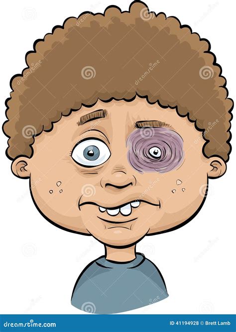 Boy with Black Eye stock illustration. Illustration of child - 41194928