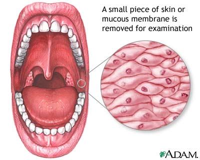 Mucous Membrane