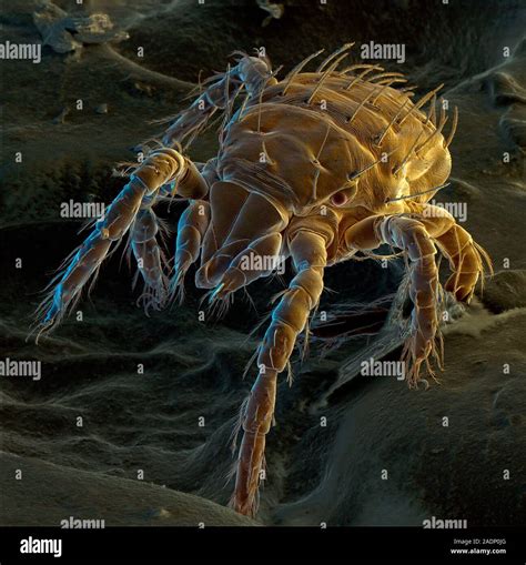 Chigger mite. Coloured Scanning Electron Micro- graph (SEM) of the ...