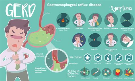 Gastroesophageal Reflux Disease (GERD): Causes, Symptoms, Diagnosis ...