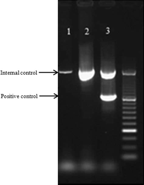 The multiplex PCR for mycoplasma contamination. Lane 1 shows the Hepe01 ...