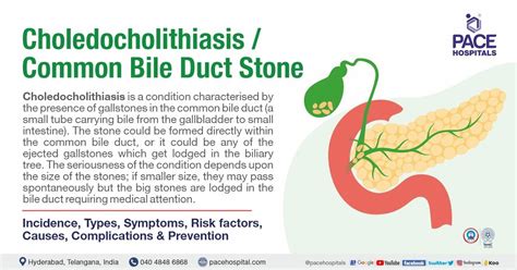 Choledocholithiasis, CBD Stone - Symptoms, Causes, Complications