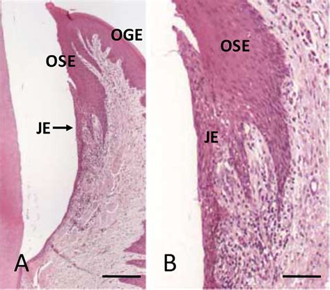 Human gingiva. A: Inner gingival epithelium consists of OSE and JE. Bar ...