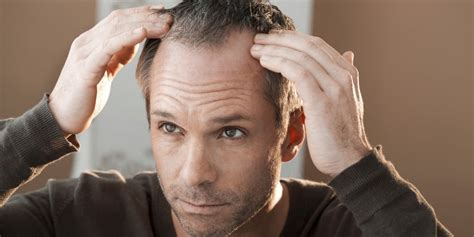 Why Men Go Bald - Page 2 - AskMen