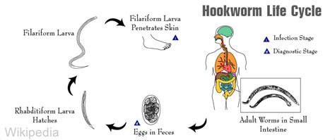 Hookworm Infection - Causes, Symptoms, Diagnosis, Treatment and Prevention