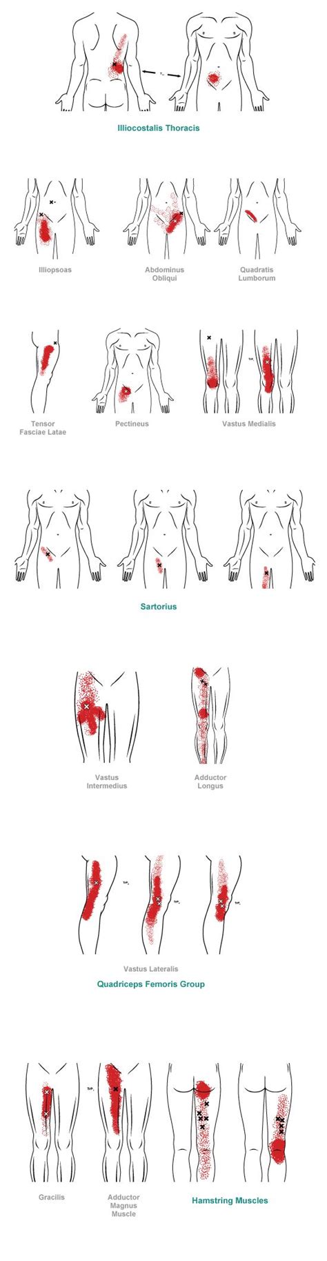 Пин на доске Trigger Points