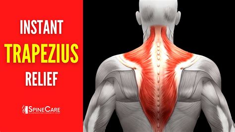 Trapezius Muscle Pain